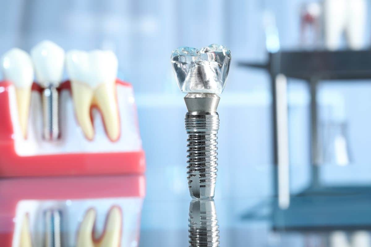Dental Implants After a Tooth Extraction