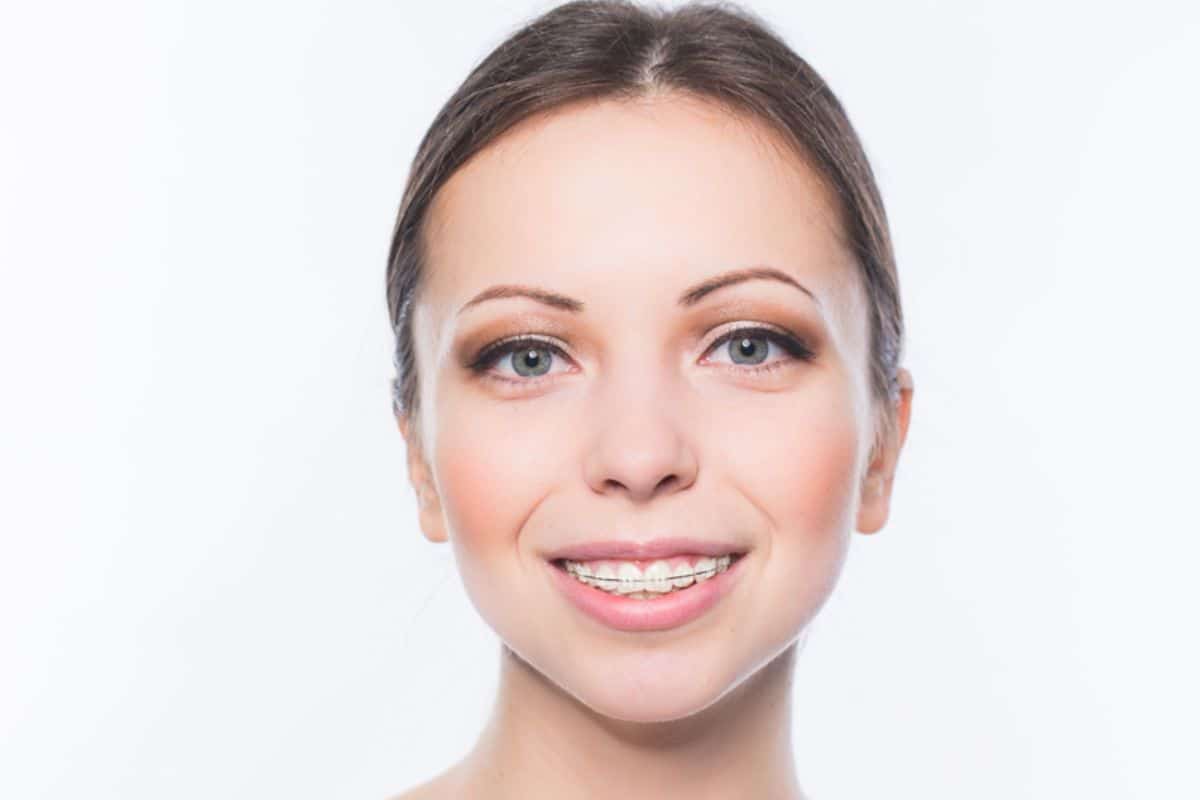 Orthodontist in brentwood