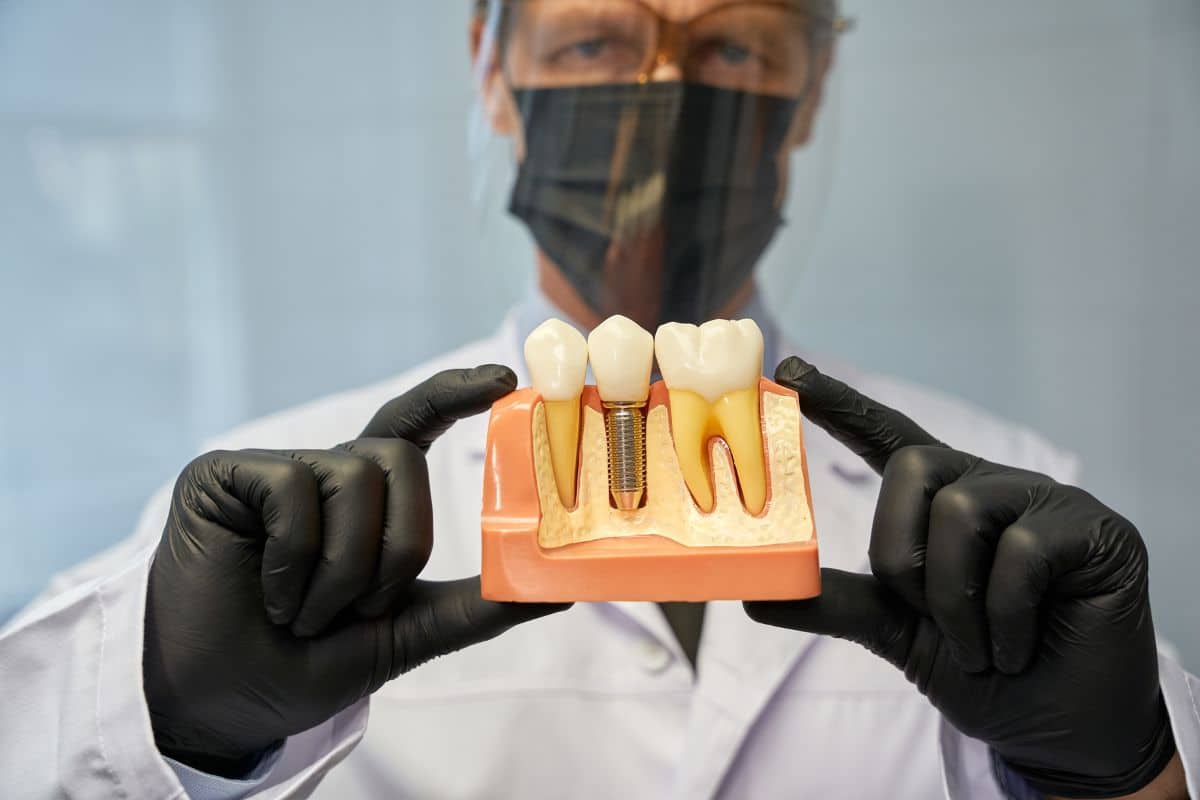 Dental Implants Brentwood