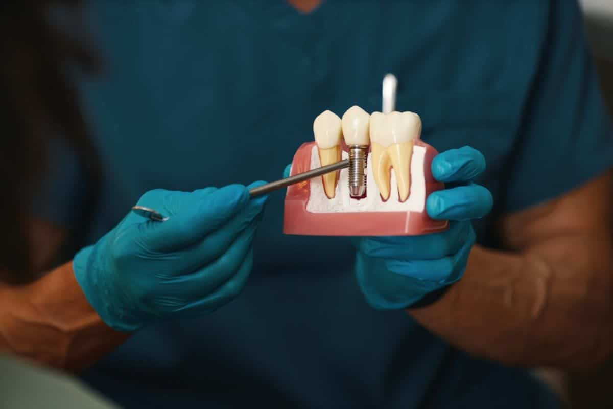Dental Implants Brentwood