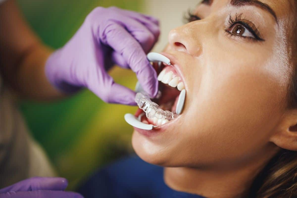 Invisalign Treatment Brentwood