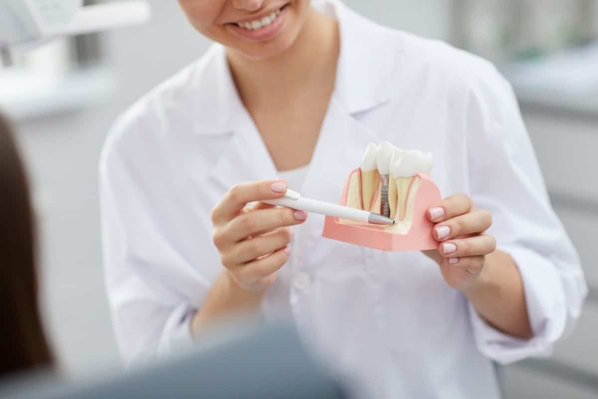Dental Implants Brentwood