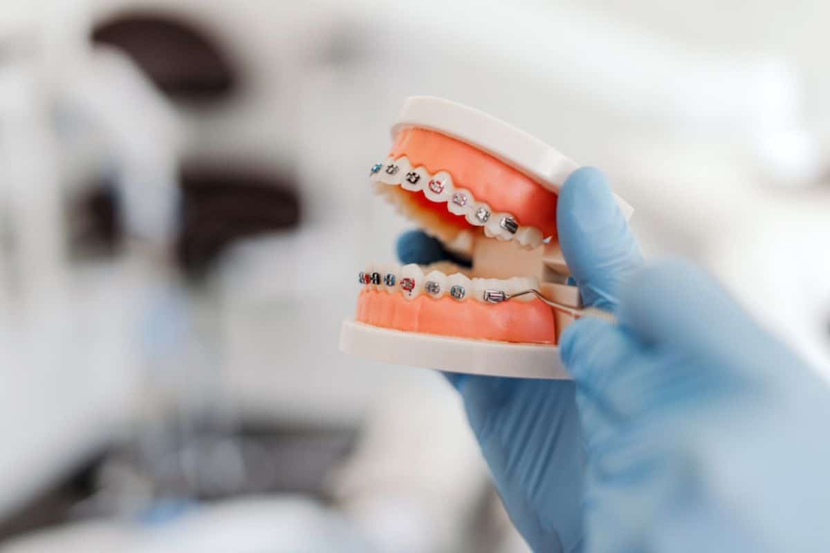 Orthodontic Treatment Brentwood