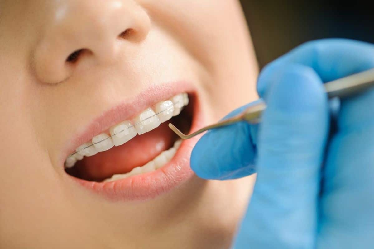 Orthodontic Treatment Brentwood