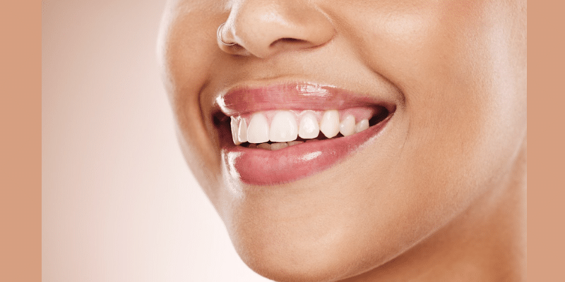 Anti-Aging Dentistry Treatments