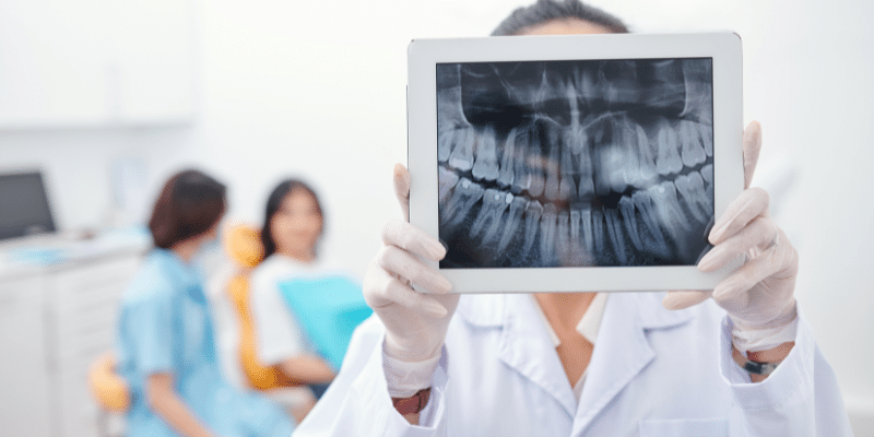 Worried About Radiation from Dental X-Rays