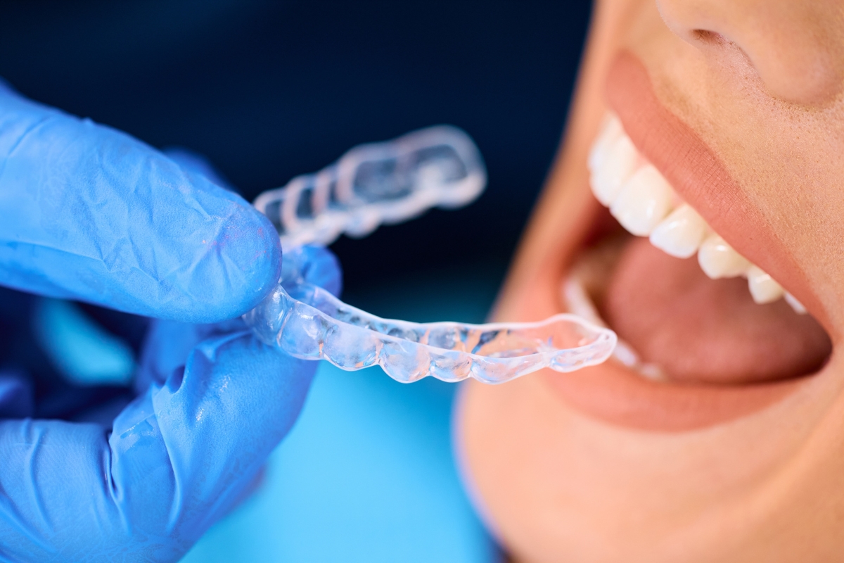 Overbite vs underbite comparison with treatment options for bite correction